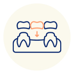Crowns and bridges Hemlock Dental Clinic specializes in crowns and bridges for restoring your smile