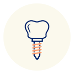 Implants Hemlock Dental Clinic offers top dental implants in Vancouver for permanent tooth replacements