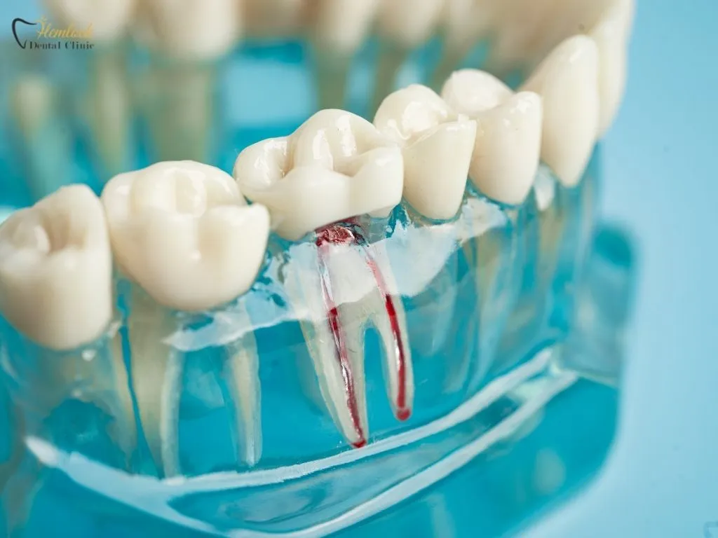 Patient discussing root canal treatment cost with dentist