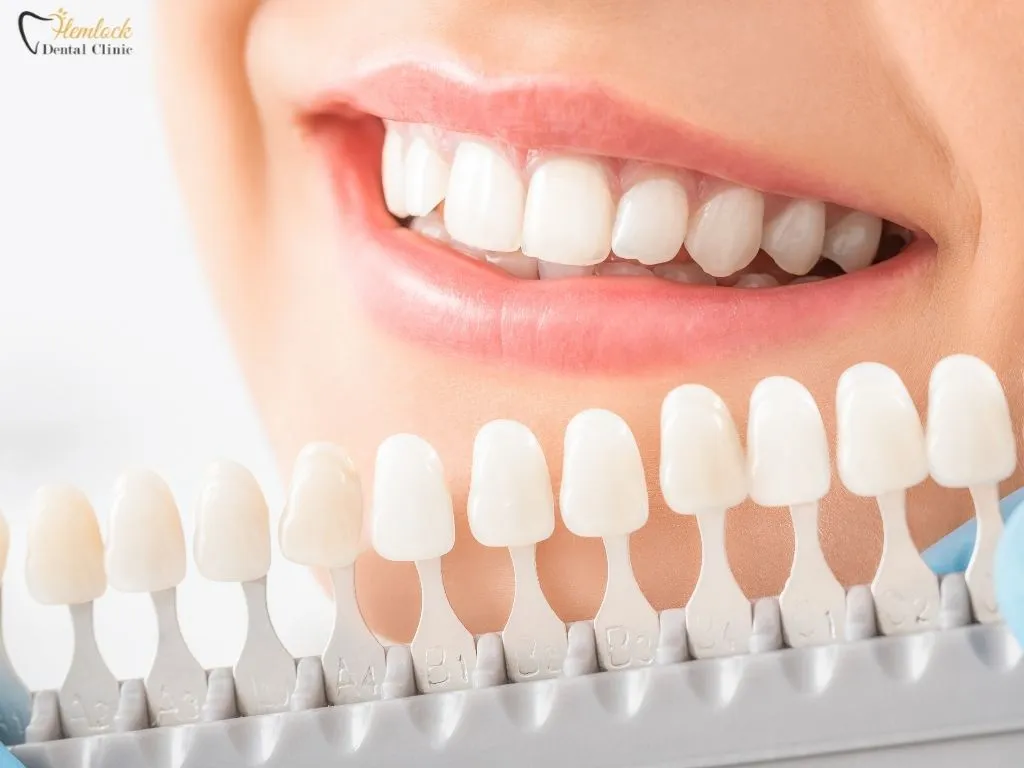Dental Crowns Bridges