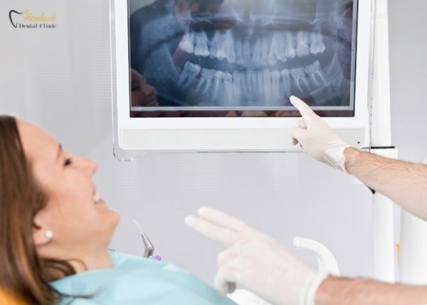 All You Need to Know About Digital Dental X-Rays 1 Types of Digital Dental X rays