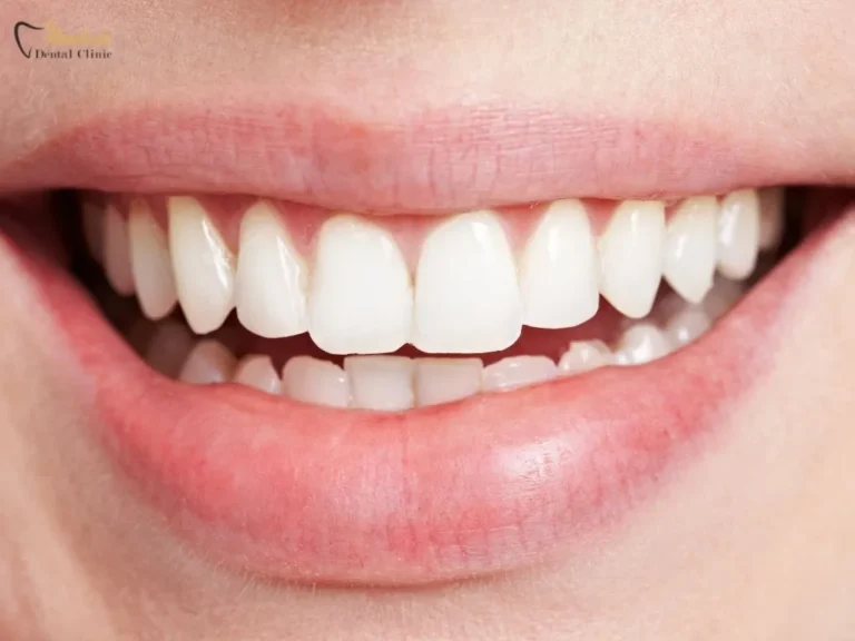 Professional-Solutions-How-to-Get-Rid-of-White-Scars-on-Teeth-Scientifically