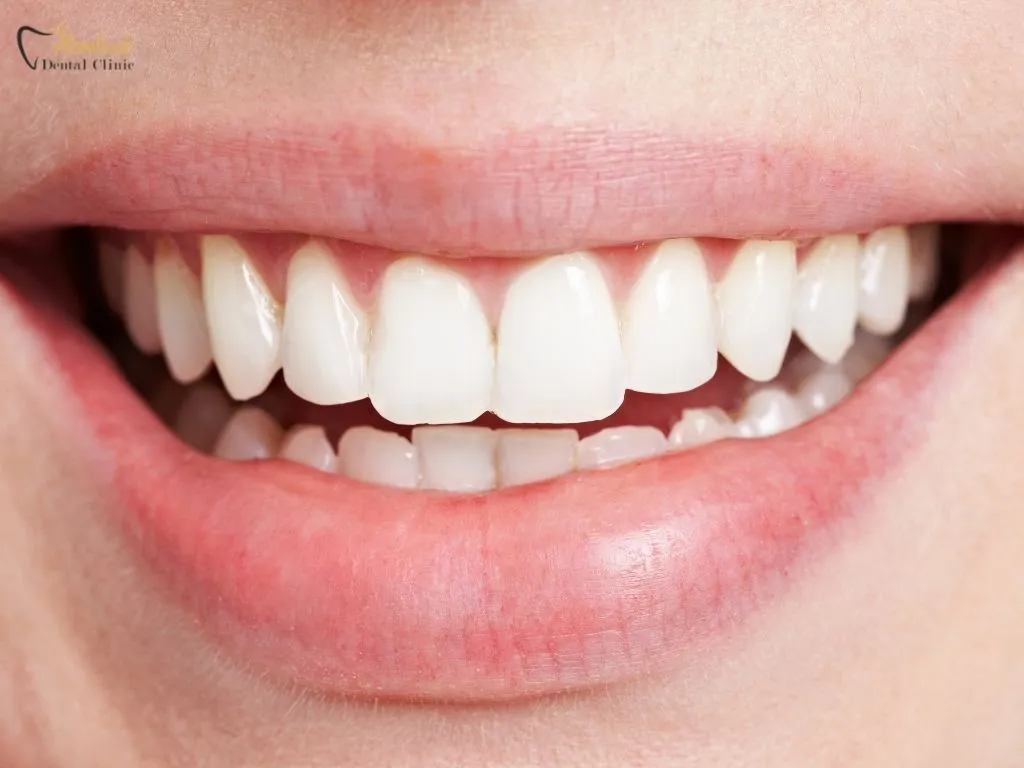 Professional-Solutions-How-to-Get-Rid-of-White-Scars-on-Teeth-Scientifically