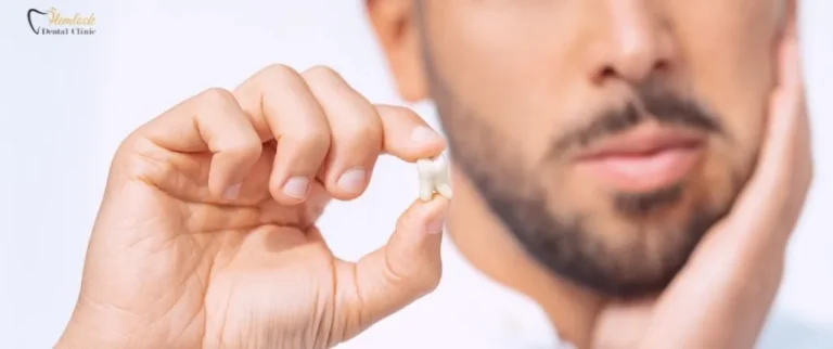 Can-a-Cracked-or-Broken-Tooth-Get-a-Root-Canal