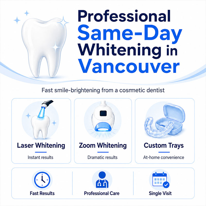 Professional-same-day-whitening-in-Vancouver-infographic-showing-laser-whitening,-Zoom-whitening,-and-custom-whitening-trays.