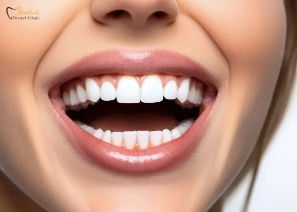 How to Whiten Teeth in a Day? 1 Woman with a bright smile after same-day teeth whitening