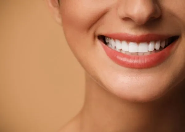 Close-up of porcelain dental veneers in Vancouver showing natural white teeth and perfect smile.