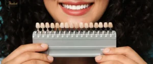 Close-up of woman holding veneer shade guide showing different tooth colors — how much are veneers in BC