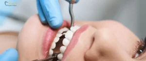 Healthy smile showing strong natural teeth – How to Avoid Root Canal