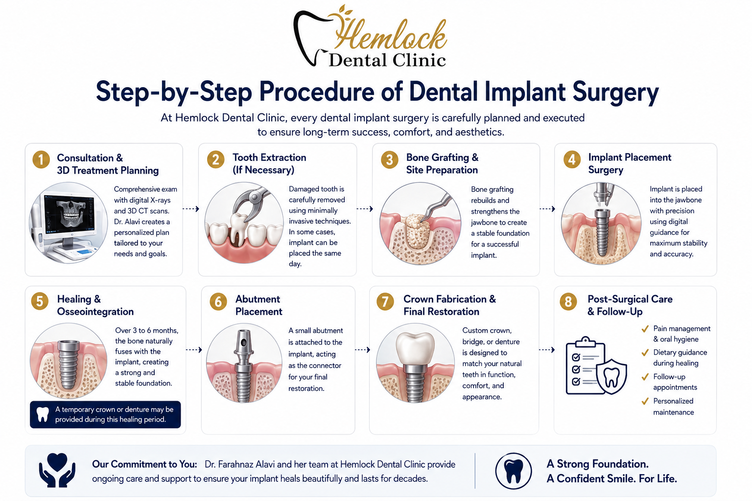 Dental Implant Surgery infographic showing the step-by-step process from consultation and 3D planning to implant placement, healing, final crown restoration, and follow-up care