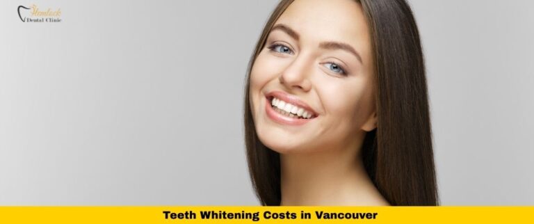 Teeth Whitening Costs in Vancouver