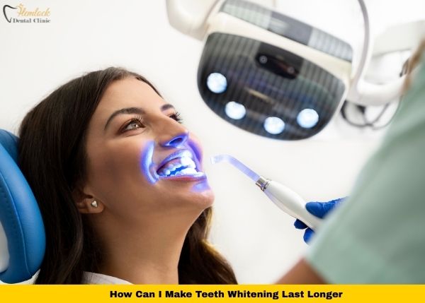 What to Eat After Teeth Whitening (White Diet Guide for Vancouver) 3 In-office teeth whitening with LED light—how to make teeth whitening last longer