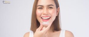 Invisalign in Vancouver: 7 Powerful Reasons to Choose It & the Real Cost of Invisalign in Vancouver