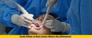 Tooth Filling vs Root Canal: What’s the Difference?
