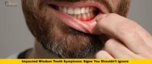 impacted wisdom tooth symptoms showing swollen red gum around lower wisdom tooth