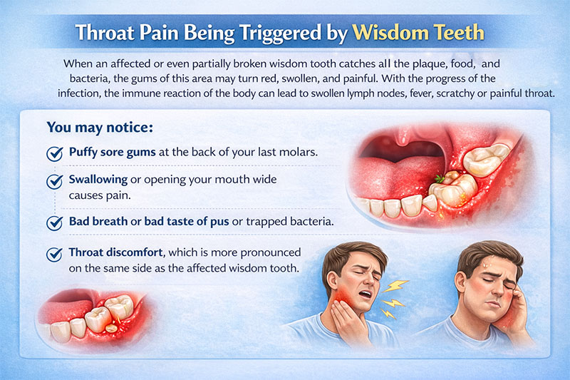Infographic explaining throat pain caused by infected or impacted wisdom teeth, showing swollen gums, bad taste, difficulty swallowing, and one-sided throat discomfort.