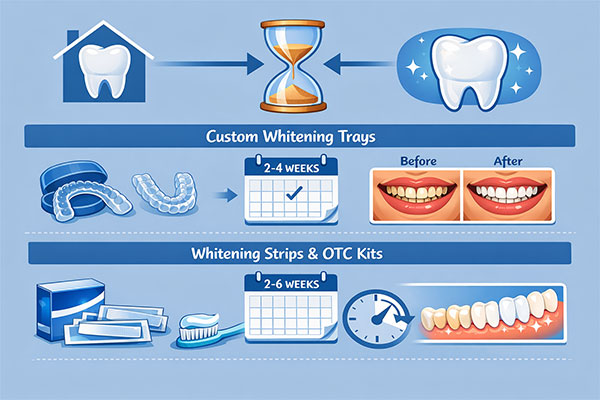 How Long Does Teeth Whitening Take? Professional & At-Home Timelines Explained 1 How long does whitening teeth take – comparison of methods including custom whitening trays (2–4 weeks) and whitening strips & OTC kits (2–6 weeks), with before-and-after teeth results shown.