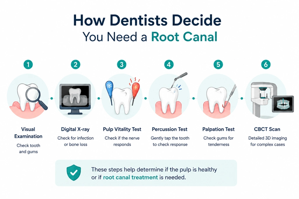 Why Do I Need a Root Canal? Vancouver Dentist Guide 2 Dental clinic Vancouver infographic explaining root canal diagnosis steps including X-ray, pulp test, CBCT scan, and clinical examination.