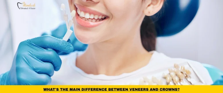 Comparison between dental veneers and crowns showing cosmetic and restorative treatment options