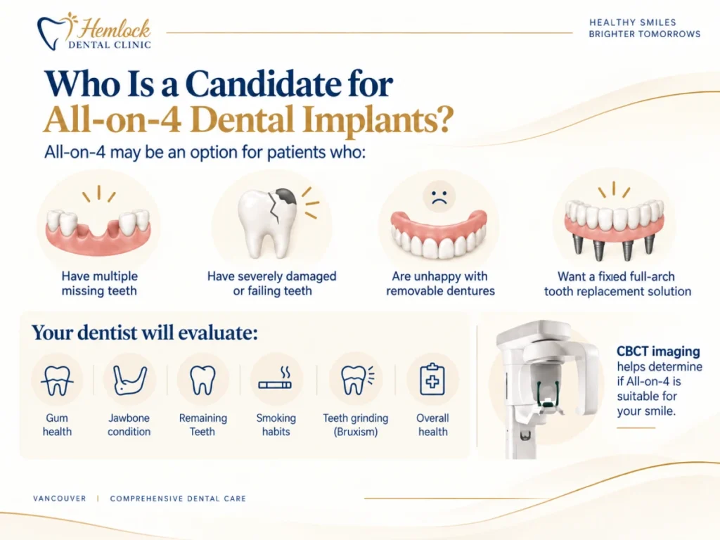 Infographic explaining who is a candidate for All-on-4 Dental Implants in Vancouver, showing patients with multiple missing teeth, severely damaged teeth, denture problems, or the need for a fixed full-arch tooth replacement solution.