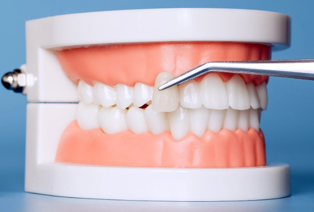 dental bite alignment