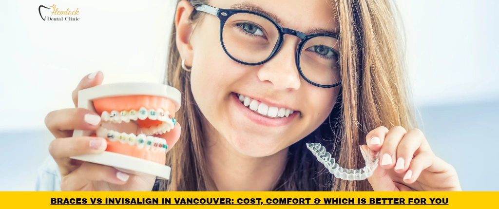 Braces vs Invisalign in Vancouver comparison showing traditional braces and clear aligners for teeth straightening