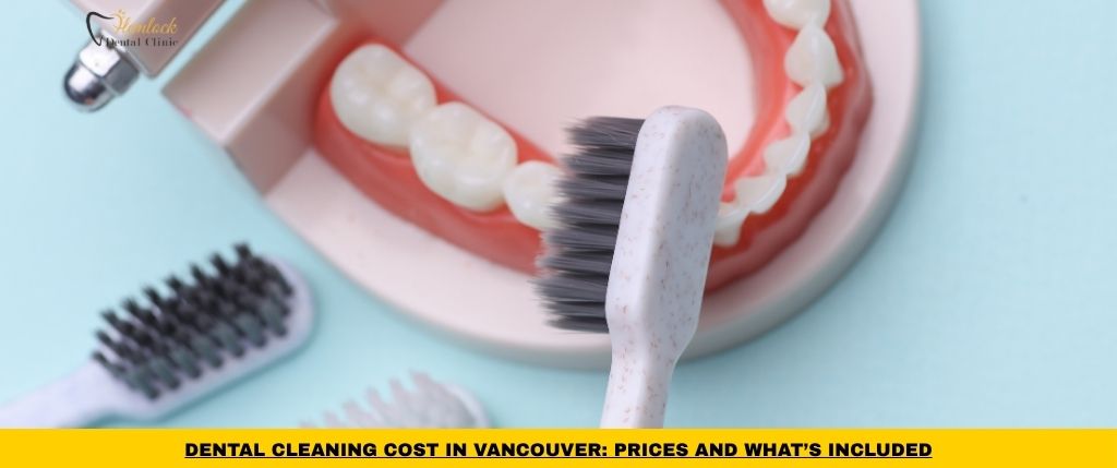 Braces vs Invisalign in Vancouver