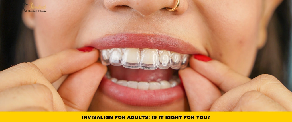 Adult wearing clear aligners for Invisalign for adults treatment