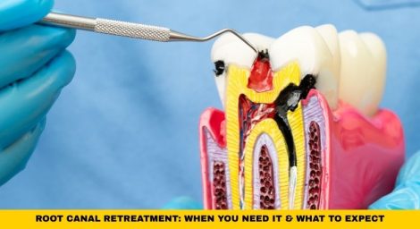 A Day by Day Wisdom Teeth Recovery Timeline