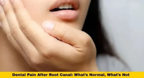 Dental Pain After Root Canal: What’s Normal, What’s Not