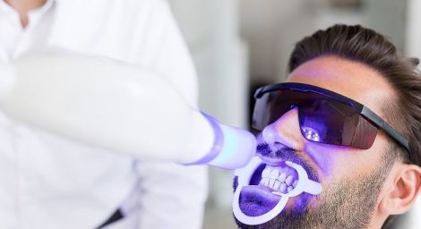 Foods to Avoid After Teeth Whitening