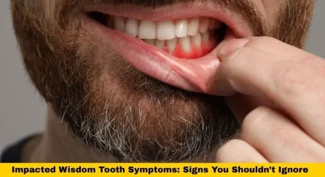 impacted wisdom tooth symptoms showing swollen red gum around lower wisdom tooth