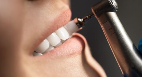 Wondering how long after dental cleaning can I eat? Learn the safe timing to protect your enamel.