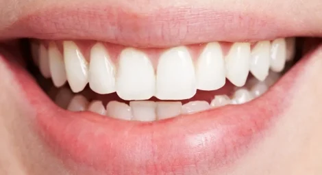 Professional-Solutions-How-to-Get-Rid-of-White-Scars-on-Teeth-Scientifically