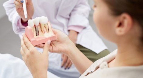 Root Canal vs Implants in Vancouver: Honest Insights from Hemlock Dental