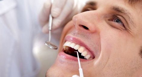 Man undergoing dental checkup after root canal in Vancouver – do you need a crown after a root canal?