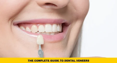 Dental veneers used to improve the appearance of stained, chipped, and uneven teeth