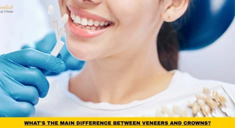 Comparison between dental veneers and crowns showing cosmetic and restorative treatment options