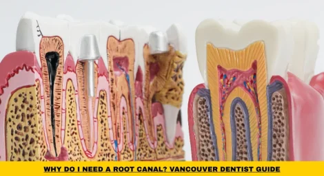 Patient experiencing tooth pain and learning why a root canal may be necessary